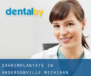 Zahnimplantate in Andersonville (Michigan)