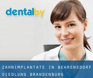 Zahnimplantate in Behrensdorf Siedlung (Brandenburg)