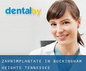 Zahnimplantate in Buckingham Heights (Tennessee)
