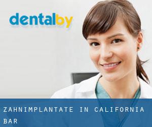 Zahnimplantate in California Bar
