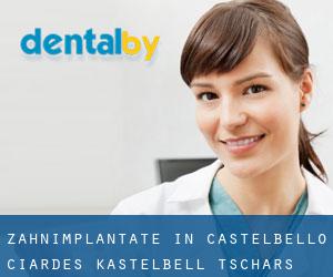 Zahnimplantate in Castelbello-Ciardes - Kastelbell-Tschars