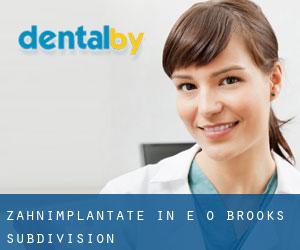 Zahnimplantate in E O Brooks Subdivision