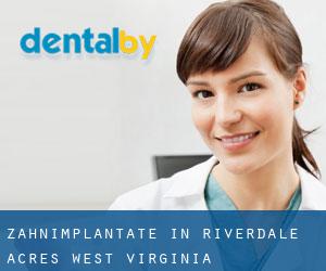 Zahnimplantate in Riverdale Acres (West Virginia)