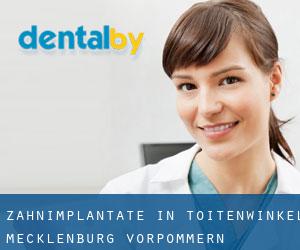 Zahnimplantate in Toitenwinkel (Mecklenburg-Vorpommern)
