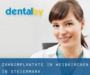Zahnimplantate in Weißkirchen in Steiermark