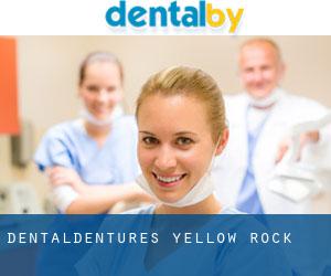 Dentaldentures (Yellow Rock)